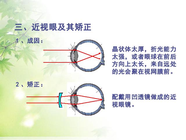 初二上册物理物理5.4眼睛和眼镜ppt原创课件（）第10页