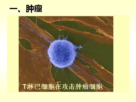 初三下册科学（教科版）新浙教版九年级科学优质课3.4非传染性疾病ppt课件第2页