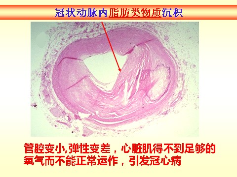 初三下册科学（教科版）浙教版九年级科学公开课3.4非传染性疾病ppt课件第5页