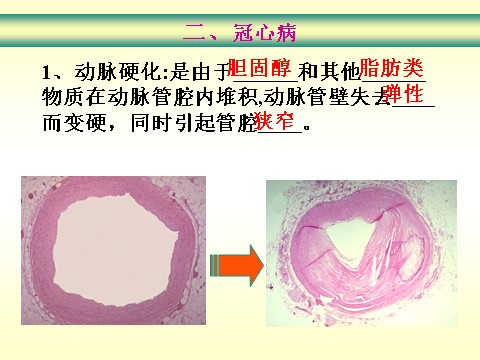 初三下册科学（教科版）浙教版九年级科学公开课3.4非传染性疾病ppt课件第6页