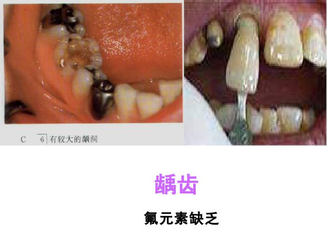 初三下册化学化学《课题2化学元素与人体健康》第4页